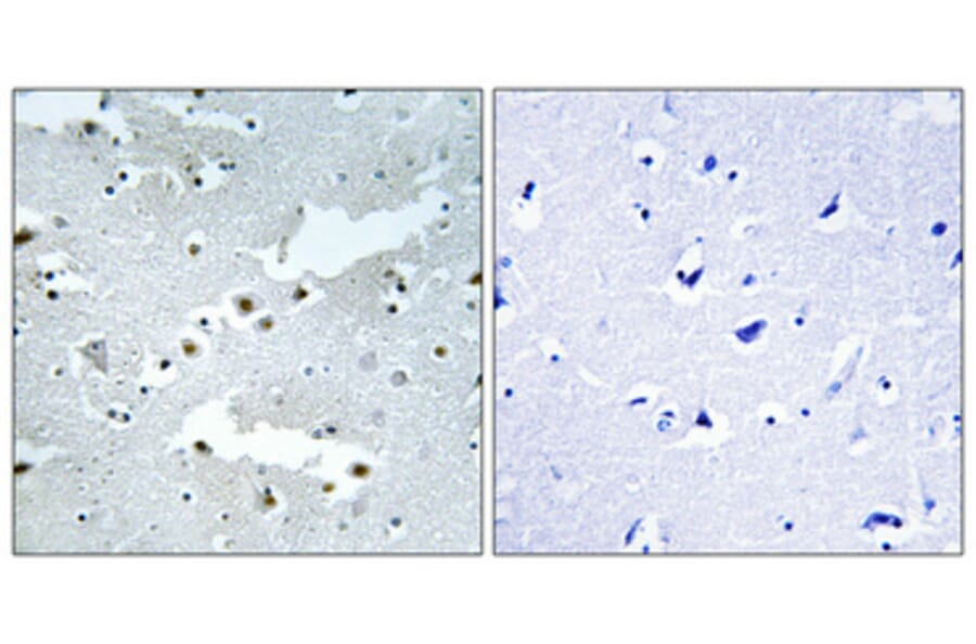 Immunohistochemistry - Anti-CDC40 Antibody (C17847) - Antibodies.com