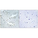 Immunohistochemistry - Anti-CDC40 Antibody (C17847) - Antibodies.com