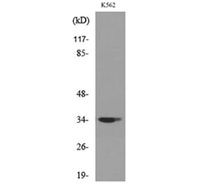 Western Blot - Anti-CDC34 Antibody (C30115) - Antibodies.com