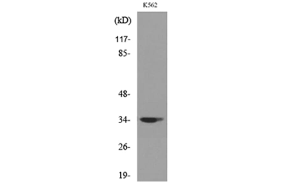 Western Blot - Anti-CDC34 Antibody (C30115) - Antibodies.com