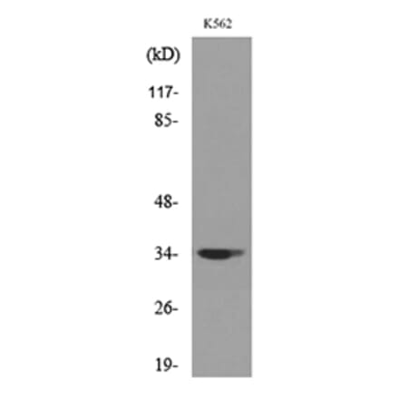 Western Blot - Anti-CDC34 Antibody (C30115) - Antibodies.com