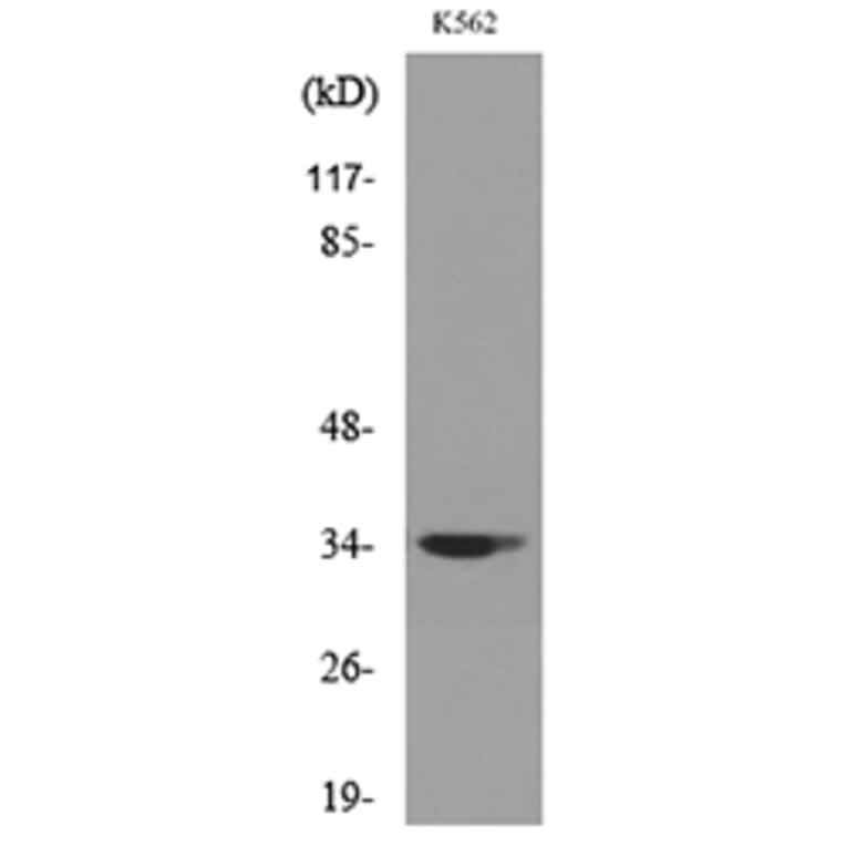 Western Blot - Anti-CDC34 Antibody (C30115) - Antibodies.com