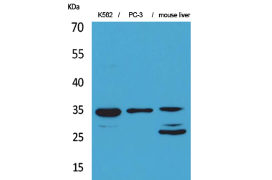 Western Blot - Anti-CDC34 Antibody (C30115) - Antibodies.com