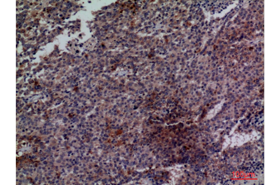Immunohistochemistry - Anti-CDC34 Antibody (C30115) - Antibodies.com