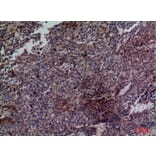 Immunohistochemistry - Anti-CDC34 Antibody (C30115) - Antibodies.com