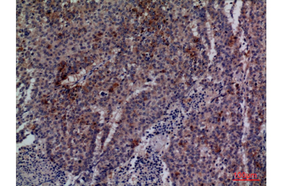 Immunohistochemistry - Anti-CDC34 Antibody (C30115) - Antibodies.com