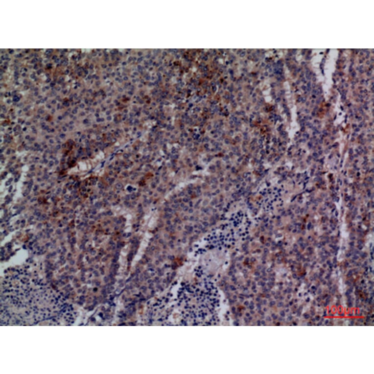 Immunohistochemistry - Anti-CDC34 Antibody (C30115) - Antibodies.com