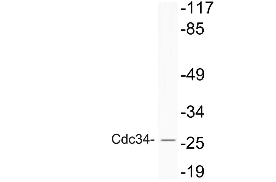 Western Blot - Anti-Cdc34 Antibody (R12-2086) - Antibodies.com