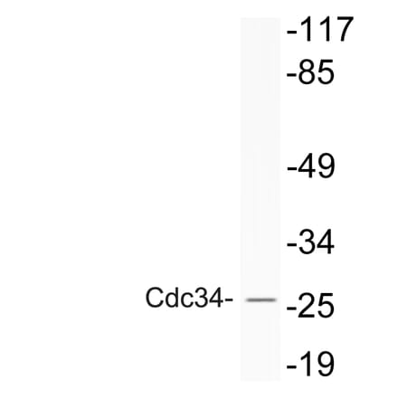 Western Blot - Anti-Cdc34 Antibody (R12-2086) - Antibodies.com