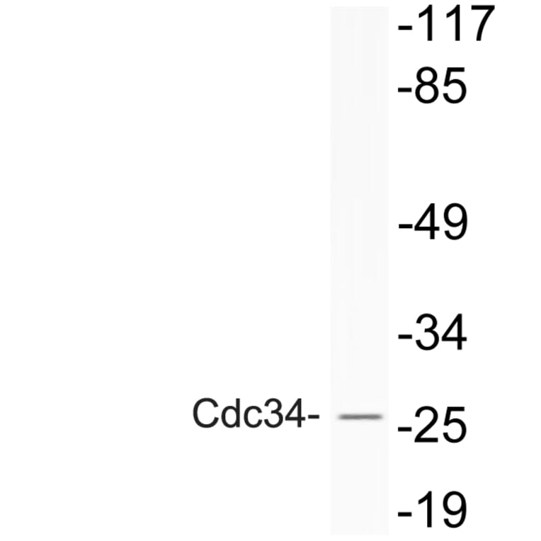 Western Blot - Anti-Cdc34 Antibody (R12-2086) - Antibodies.com
