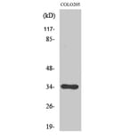Western Blot - Anti-Cdc34 Antibody (R12-2086) - Antibodies.com