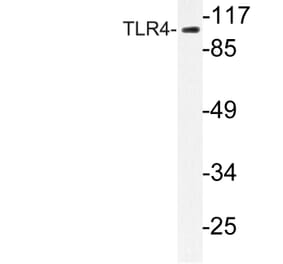 Western Blot - Anti-CD284 Antibody (R12-2073) - Antibodies.com