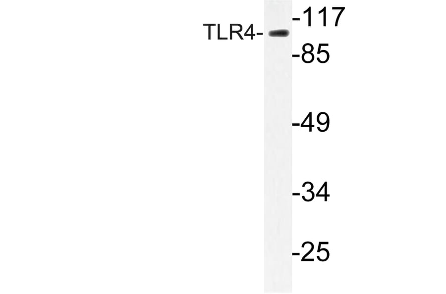 Western Blot - Anti-CD284 Antibody (R12-2073) - Antibodies.com