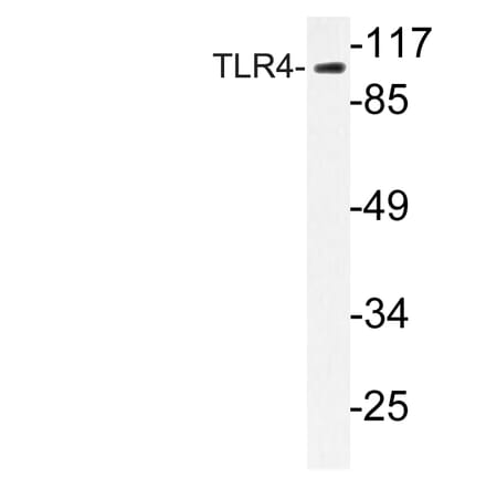 Western Blot - Anti-CD284 Antibody (R12-2073) - Antibodies.com
