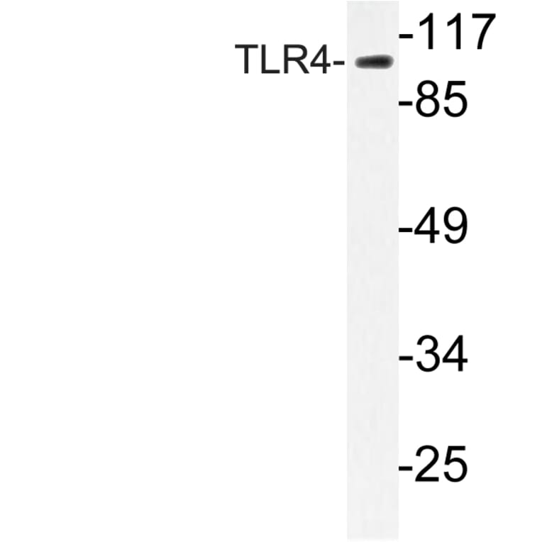 Western Blot - Anti-CD284 Antibody (R12-2073) - Antibodies.com