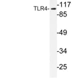 Western Blot - Anti-CD284 Antibody (R12-2073) - Antibodies.com
