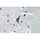 Immunohistochemistry - Anti-CD284 Antibody (R12-2073) - Antibodies.com