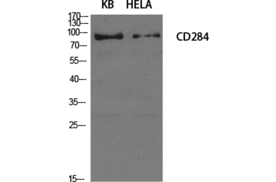 Western Blot - Anti-CD284 Antibody (R12-2073) - Antibodies.com