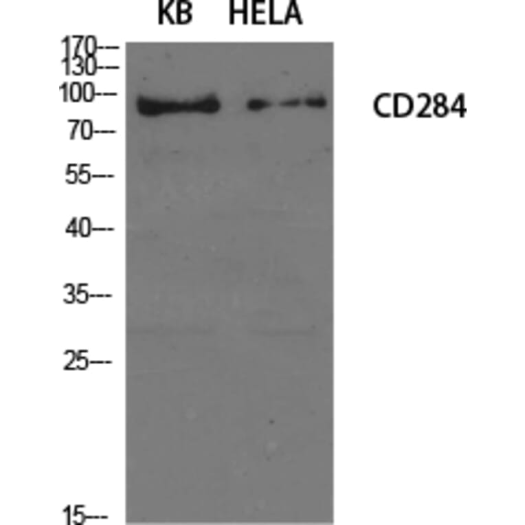 Western Blot - Anti-CD284 Antibody (R12-2073) - Antibodies.com