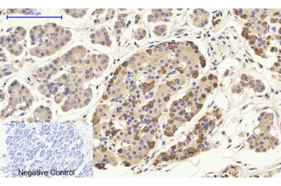 Immunohistochemistry - Anti-CD284 Antibody (R12-2073) - Antibodies.com