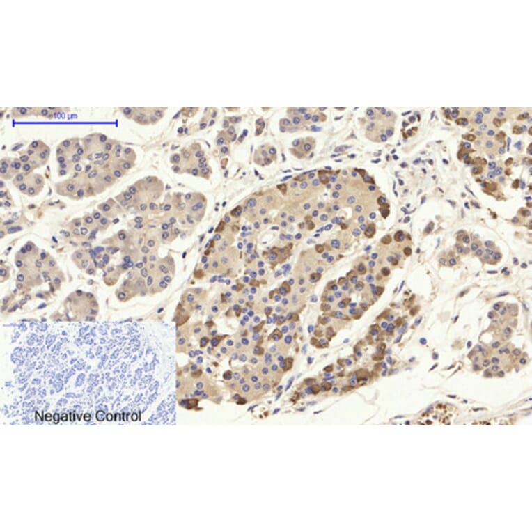 Immunohistochemistry - Anti-CD284 Antibody (R12-2073) - Antibodies.com