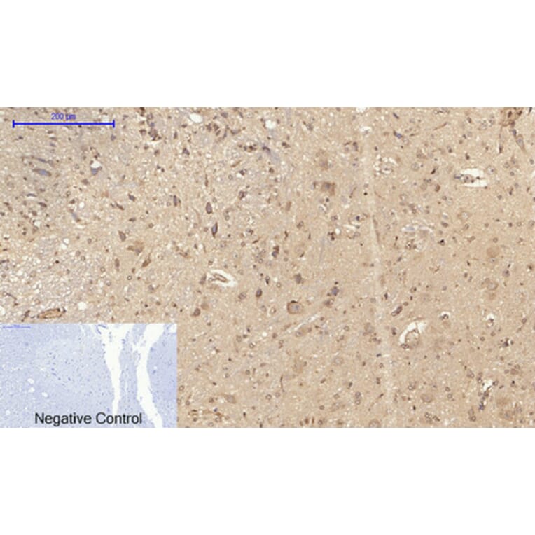 Immunohistochemistry - Anti-CD284 Antibody (R12-2073) - Antibodies.com