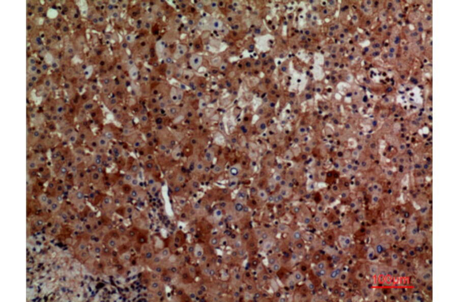 Immunohistochemistry - Anti-CD276 Antibody (C30551) - Antibodies.com