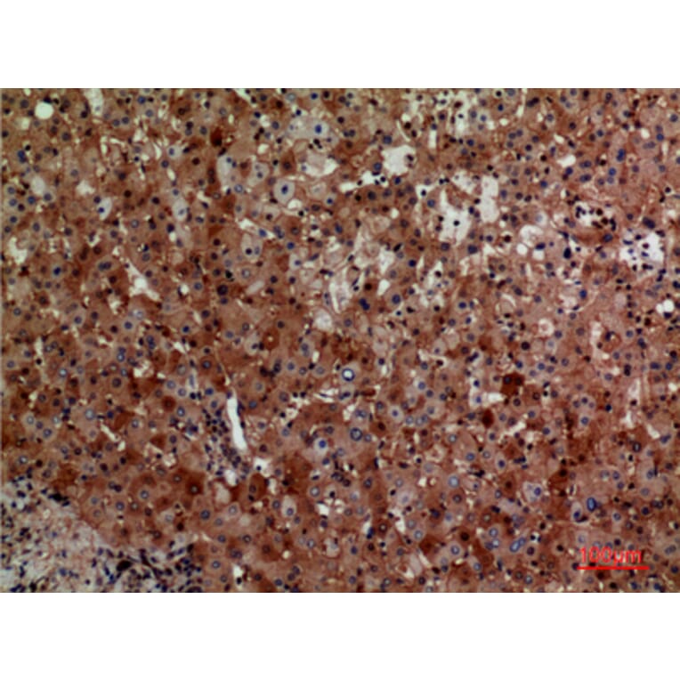 Immunohistochemistry - Anti-CD276 Antibody (C30551) - Antibodies.com