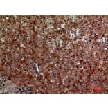Immunohistochemistry - Anti-CD276 Antibody (C30551) - Antibodies.com