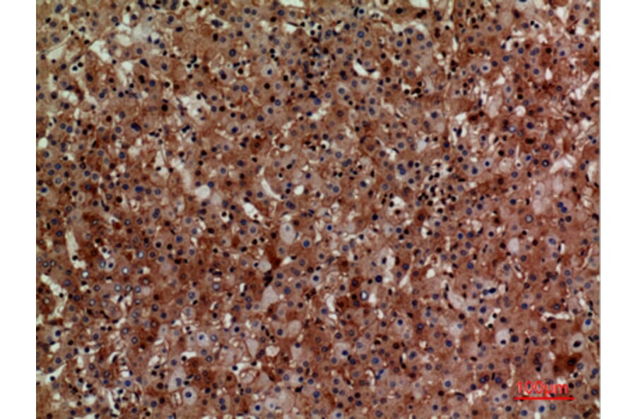 Immunohistochemistry - Anti-CD276 Antibody (C30551) - Antibodies.com