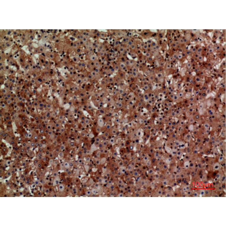 Immunohistochemistry - Anti-CD276 Antibody (C30551) - Antibodies.com