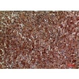 Immunohistochemistry - Anti-CD276 Antibody (C30551) - Antibodies.com