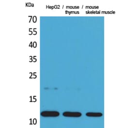 Western Blot - Anti-CCL11 Antibody (C30181) - Antibodies.com