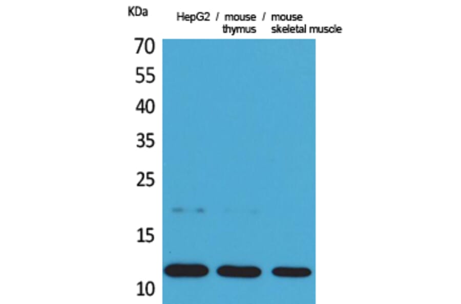 Western Blot - Anti-CCL11 Antibody (C30181) - Antibodies.com