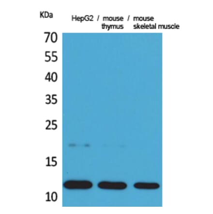 Western Blot - Anti-CCL11 Antibody (C30181) - Antibodies.com