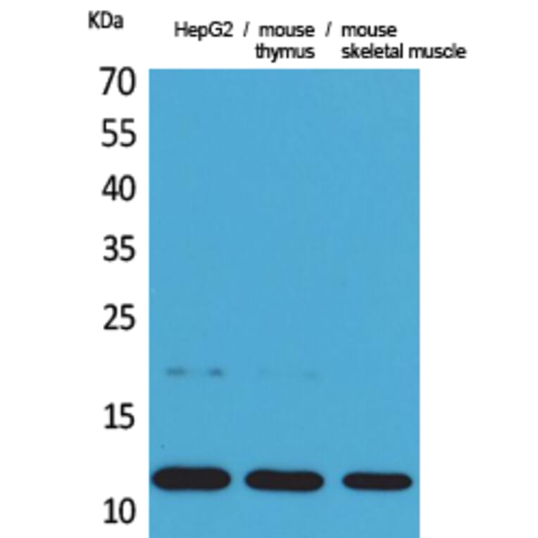 Western Blot - Anti-CCL11 Antibody (C30181) - Antibodies.com