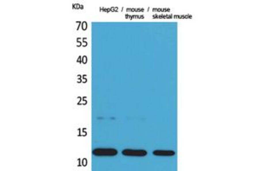 Western Blot - Anti-CCL11 Antibody (C30181) - Antibodies.com