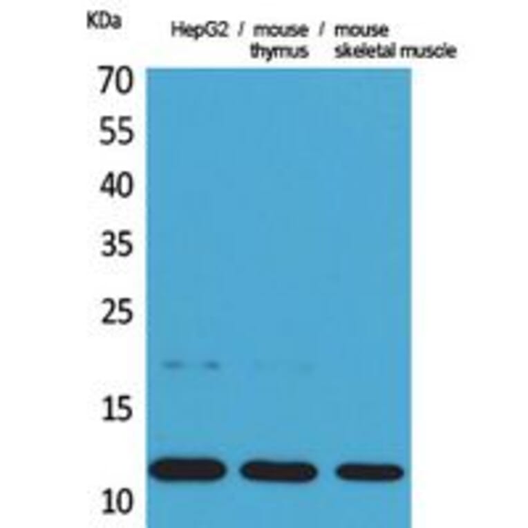 Western Blot - Anti-CCL11 Antibody (C30181) - Antibodies.com