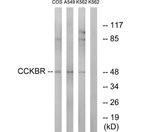 Western Blot - Anti-CCKBR Antibody (G069) - Antibodies.com