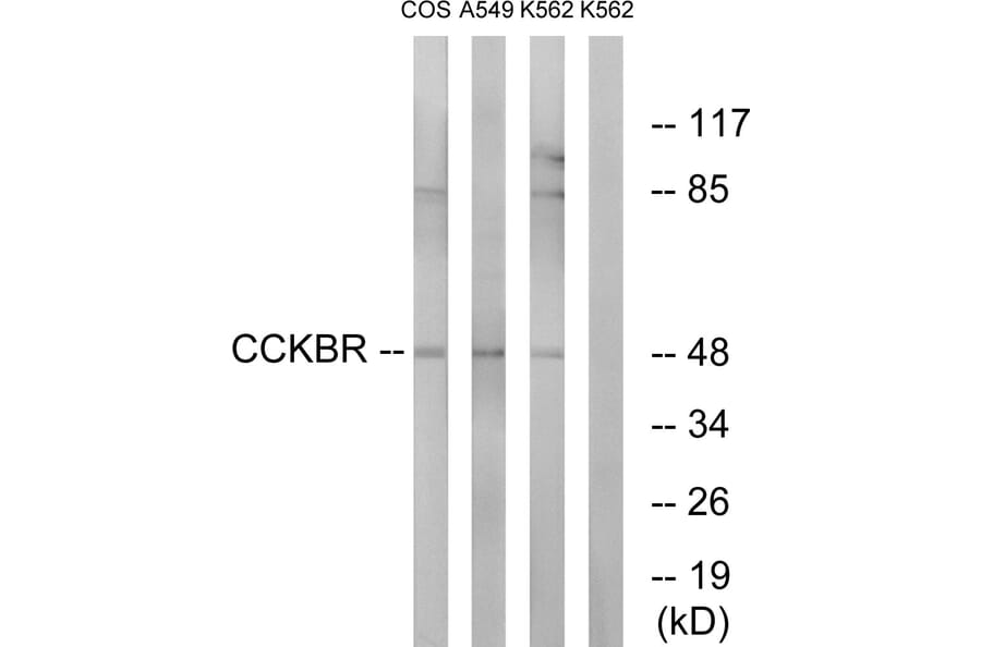 Western Blot - Anti-CCKBR Antibody (G069) - Antibodies.com
