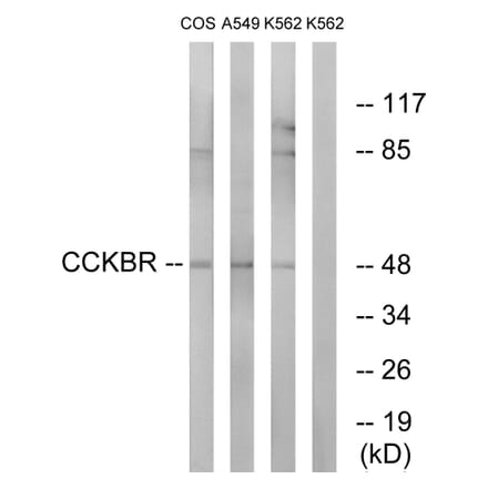 Western Blot - Anti-CCKBR Antibody (G069) - Antibodies.com