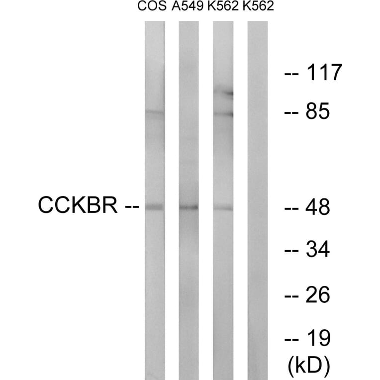 Western Blot - Anti-CCKBR Antibody (G069) - Antibodies.com