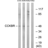 Western Blot - Anti-CCKBR Antibody (G069) - Antibodies.com