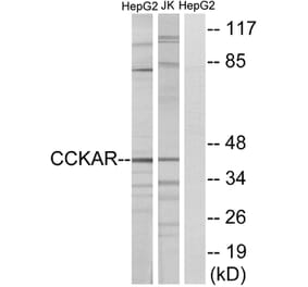 Western Blot - Anti-CCKAR Antibody (G222) - Antibodies.com