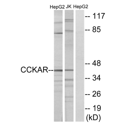 Western Blot - Anti-CCKAR Antibody (G222) - Antibodies.com