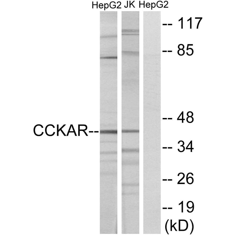 Western Blot - Anti-CCKAR Antibody (G222) - Antibodies.com