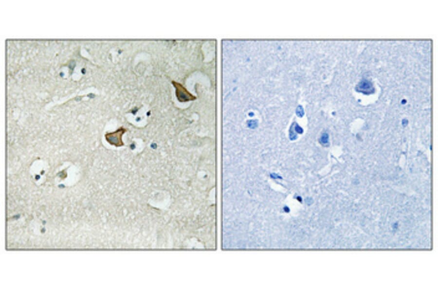 Immunohistochemistry - Anti-CCKAR Antibody (G222) - Antibodies.com