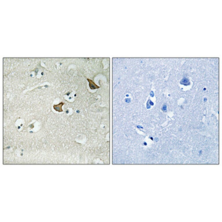 Immunohistochemistry - Anti-CCKAR Antibody (G222) - Antibodies.com