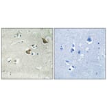 Immunohistochemistry - Anti-CCKAR Antibody (G222) - Antibodies.com