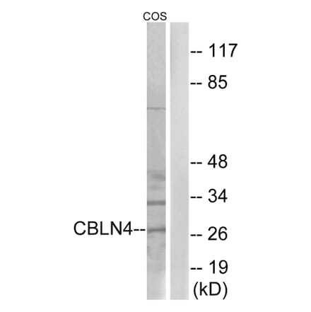 Western Blot - Anti-CBLN4 Antibody (C15059) - Antibodies.com